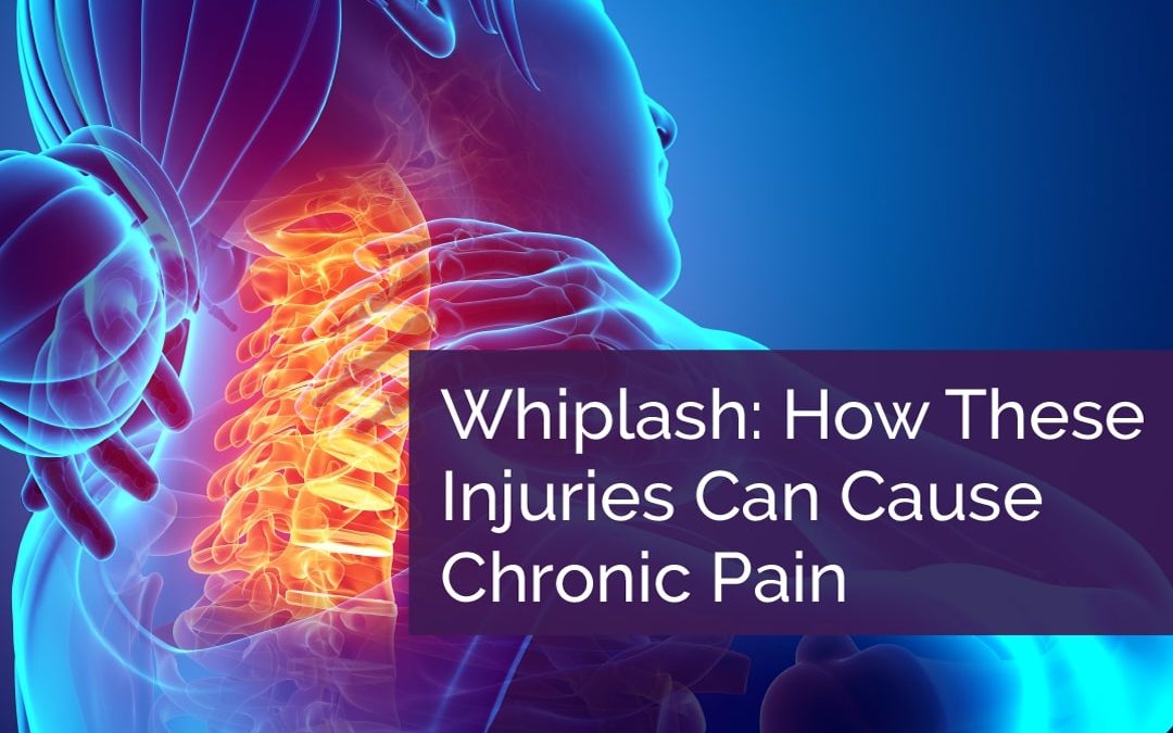 Whiplash: How These Injuries Can Cause Chronic Pain